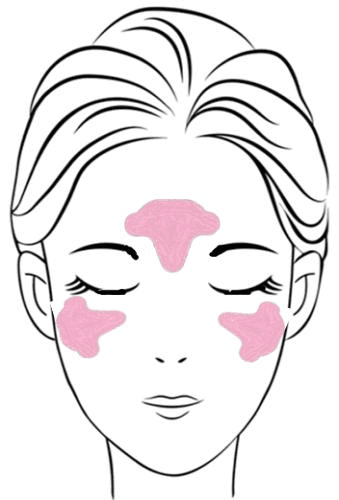 부채꼴 패치 사용 부위
